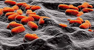 Ammonia Oxidizing Bacteria (AOB)