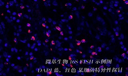 FISH探针试剂盒